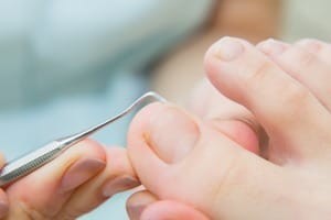 footcare_img013
